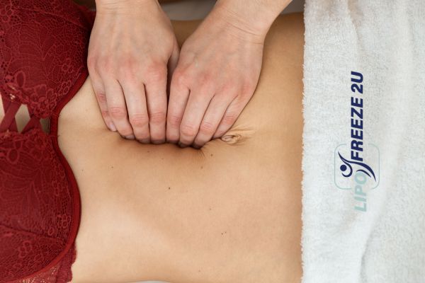diastasis recti treatment Cannock