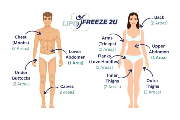Areas you can have fat freezing treatment Cannock
