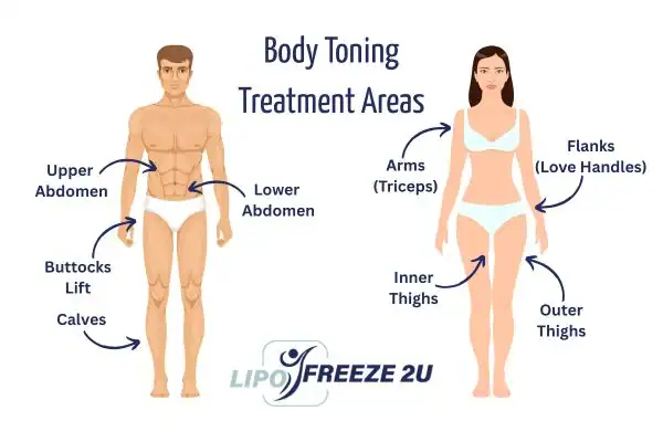 Graphic showing where you can have Body toning Treatment Cannock on your body