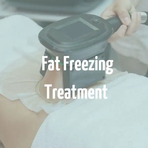 fat freezing treatment Cannock