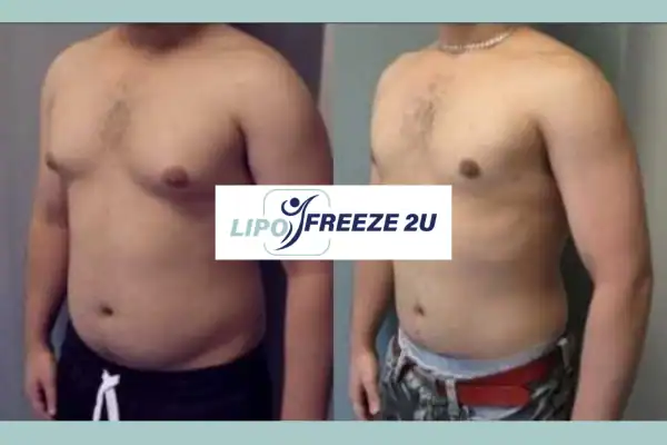 How Long Does It Take to See Results Cannock?