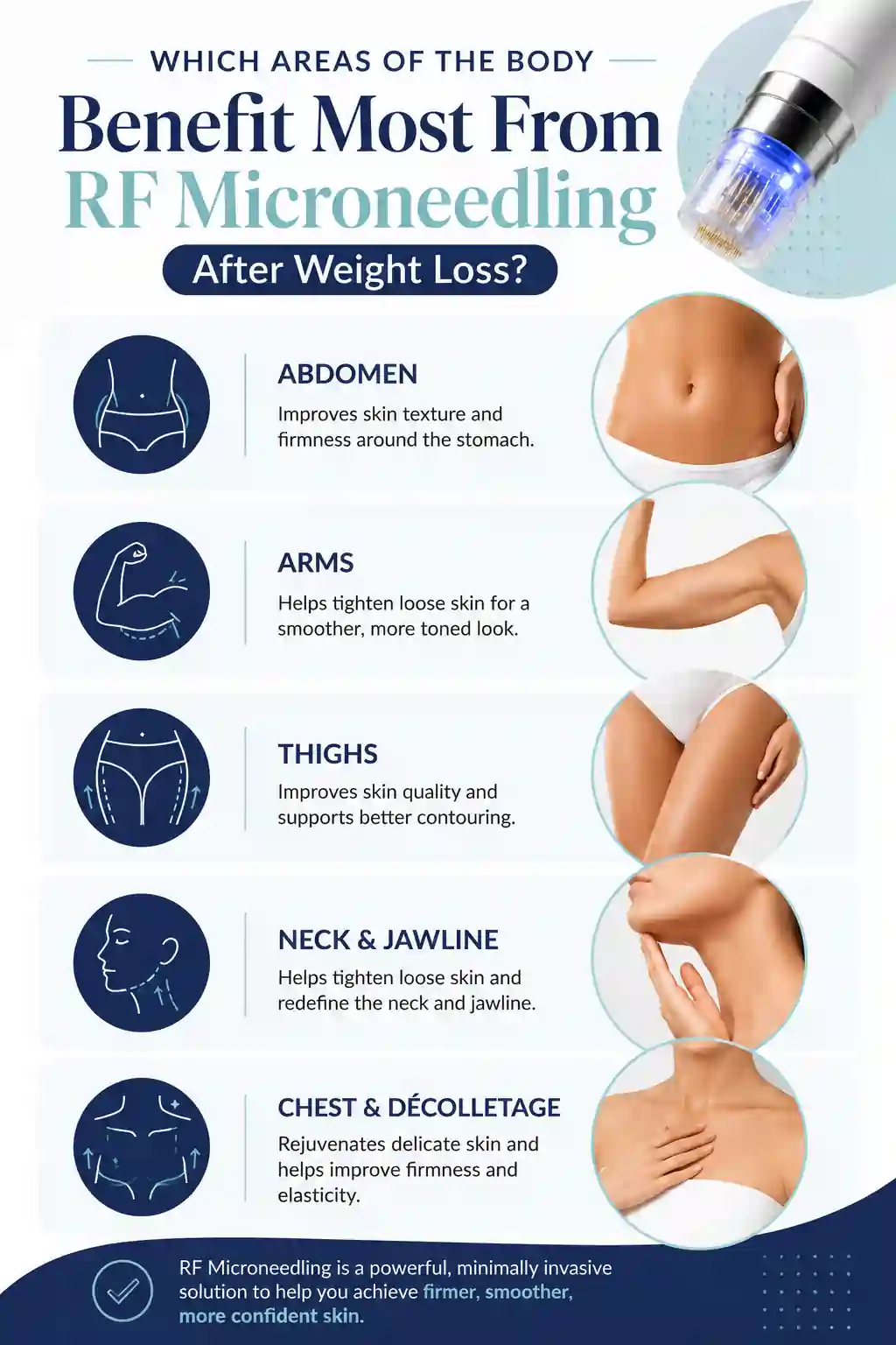 Which Areas of the Body Benefit Most From RF Microneedling After Weight Loss Cannock